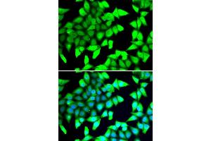 Immunofluorescence analysis of A549 cells using HDAC5 antibody. (HDAC5 anticorps)