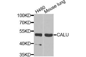 Western blot analysis of extracts of H460 and mouse lung cells, using CALU antibody. (CALU anticorps)