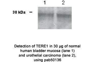 Image no. 1 for anti-UbiA Prenyltransferase Domain Containing 1 (UBIAD1) (N-Term) antibody (ABIN363445) (UBIAD1 anticorps  (N-Term))