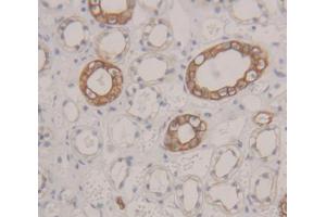 IHC-P analysis of Human Tissue, with DAB staining. (CD51 anticorps  (AA 560-744))