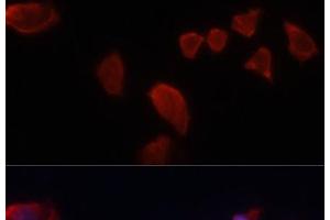 Immunofluorescence analysis of HeLa cells using CA9 Polyclonal Antibody at dilution of 1:100. (CA9 anticorps)