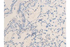 ABIN6267244 at 1/100 staining mouse lung tissue sections by IHC-P.