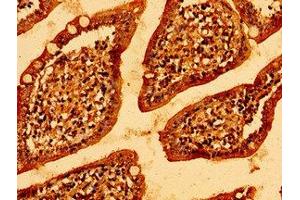 Immunohistochemistry of paraffin-embedded human small intestine tissue using ABIN7146314 at dilution of 1:100