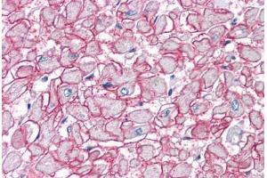 Human Heart: Formalin-Fixed, Paraffin-Embedded (FFPE) (SGCB anticorps  (AA 87-197))