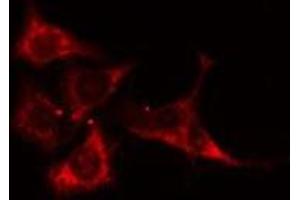 ABIN6275132 staining MCF7 cells by IF/ICC. (ALDOB anticorps  (C-Term))