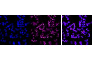 Immunocytochemical staining of HeLa cells with Phospho-ErbB2 (Y) antibody (ABIN7800159), 1:1,000).