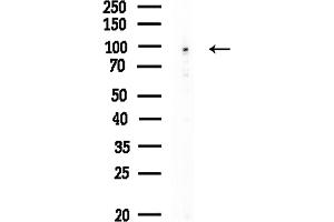 Western blot analysis of lysates from HUVEC cells, using ZZZ3 Antibody at 1/1000 dilution.