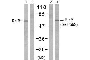 Western blot analysis of extracts from A431 cells, untreated or treated with EGF (200ng/ml 10min), using RelB (Ab-552) antibody (E021247, Line 1 and 2) and RelB (phospho-Ser552) antibody (E011255, Line 3 and 4). (RELB anticorps)