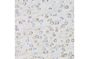 Immunohistochemistry of paraffin-embedded mouse brain using MIP antibody (ABIN5971491) at dilution of 1/100 (40x lens). (MIP anticorps)