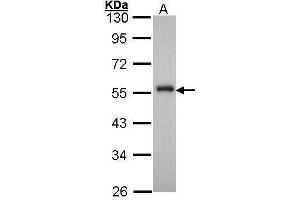 WB Image Sample (30 ug of whole cell lysate) A: Hep G2 , 10% SDS PAGE antibody diluted at 1:1000 (FOXA1 anticorps  (C-Term))