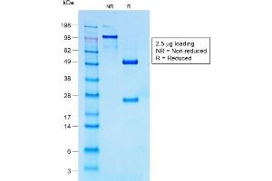 SDS-PAGE Analysis of Purified CD30 Rabbit Recombinant Monoclonal Antibody (Ki-1/1747R). (Recombinant TNFRSF8 anticorps)