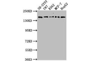 Western Blot Positive WB detected in: SH-SY5Y whole cell lysate, U87 whole cell lysate, K562 whole cell lysate, MCF-7 whole cell lysatee, HepG2 whole cell lysate All lanes: INSRR antibody at 1:2000 Secondary Goat polyclonal to rabbit IgG at 1/50000 dilution Predicted band size: 144 kDa Observed band size: 144 kDa (INSRR anticorps  (AA 747-921))