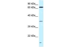 Western Blot showing VPS26A antibody used at a concentration of 1 ug/ml against Fetal Kidney Lysate (VPS26A anticorps  (C-Term))