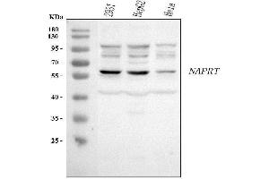 Western blot analysis of NAPRT using anti-NAPRT antibody (ABIN7602305).
