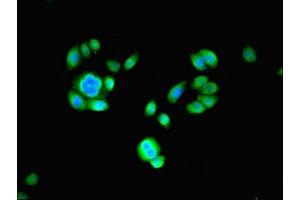 Immunofluorescent analysis of PC-3 cells using ABIN7164973 at dilution of 1:100 and Alexa Fluor 488-congugated AffiniPure Goat Anti-Rabbit IgG(H+L)