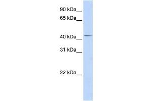 Western Blotting (WB) image for anti-DENN/MADD Domain Containing 1B (DENND1B) antibody (ABIN2459576) (DENND1B anticorps)