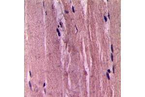 Immunohistochemical analysis of Smooth Muscle Actin staining in human skeletal muscle formalin fixed paraffin embedded tissue section.