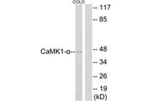 Western Blotting (WB) image for anti-Calcium/calmodulin-Dependent Protein Kinase I (CAMK1) (AA 143-192) antibody (ABIN2888788) (CAMK1 anticorps  (AA 143-192))