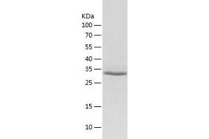 Western Blotting (WB) image for Proto-Oncogene Pim-2 (Serine Threonine Kinase) (PIM2) (AA 1-311) protein (His tag) (ABIN7124698) (PIM2 Protein (AA 1-311) (His tag))