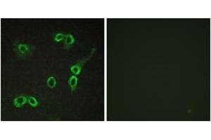 Immunofluorescence analysis of COS7 cells, using C3AR1 Antibody. (C3AR1 anticorps  (AA 175-224))