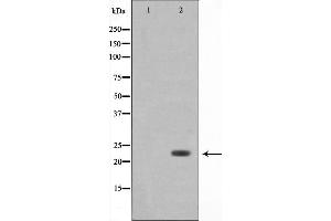 Western blot analysis on 293 cell lysate using Bak Antibody,The lane on the left is treated with the antigen-specific peptide. (BAK1 anticorps  (N-Term))