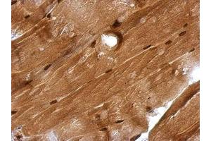 Image no. 1 for anti-Glucocorticoid Modulatory Element Binding Protein 1 (GMEB1) (AA 315-573) antibody (ABIN1501891)