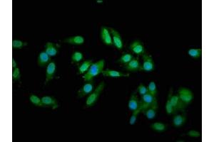 Immunofluorescence staining of Hela cells with ABIN7173586 at 1:66, counter-stained with DAPI.