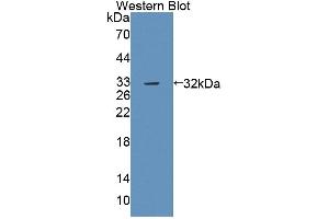 Western blot analysis of the recombinant protein. (PTPRB anticorps  (AA 1214-1463))