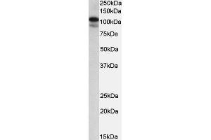 ABIN2559827 (0. (SATB1 anticorps  (Internal Region))