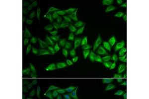 Immunofluorescence analysis of U2OS cells using TPMT Polyclonal Antibody (TPMT anticorps)
