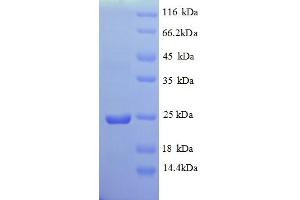 SDS-PAGE (SDS) image for Vesicle-Associated Membrane Protein 7 (VAMP7) (AA 2-181), (Cytoplasmic Domain), (Cytosolic) protein (His tag) (ABIN5710604)