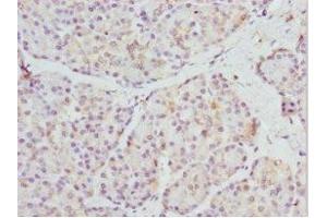 Immunohistochemistry of paraffin-embedded human pancreatic tissue using ABIN7168685 at dilution of 1:100 (FRZB anticorps  (AA 166-325))