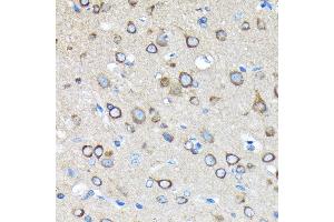 Immunohistochemistry of paraffin-embedded rat brain using Huntingtin Rabbit mAb (ABIN7267793) at dilution of 1:100 (40x lens). (Huntingtin anticorps)