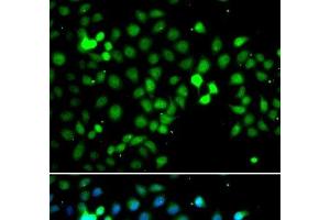 Immunofluorescence analysis of A549 cells using MTF2 Polyclonal Antibody (MTF2 anticorps)