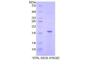 SDS-PAGE (SDS) image for Relaxin (AA 25-181) protein (His tag) (ABIN1878279) (Relaxin Protein (AA 25-181) (His tag))