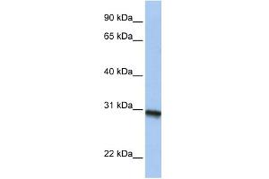 WB Suggested Anti-C20orf195 Antibody Titration: 0. (C20orf195 anticorps  (N-Term))