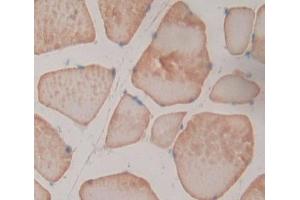 Used in DAB staining on fromalin fixed paraffin- embedded skeletal muscle tissue (NT5M anticorps  (AA 30-209))