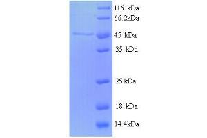 SDS-PAGE (SDS) image for Ribonucleotide Reductase M2 (RRM2) (AA 2-376) protein (His tag) (ABIN5713968)