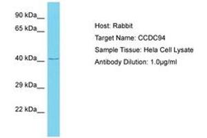 Image no. 1 for anti-Coiled-Coil Domain Containing 94 (CCDC94) (AA 239-288) antibody (ABIN6750639) (CCDC94 anticorps  (AA 239-288))