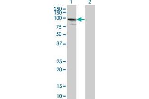 anti-Zinc Finger Protein 274 (ZNF274) (AA 420-530) antibody