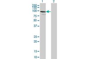 Western Blot analysis of ZNF274 expression in transfected 293T cell line by ZNF274 monoclonal antibody (M01), clone 4C12. (ZNF274 anticorps  (AA 420-530))