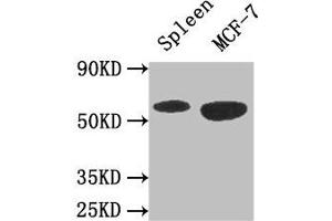 Western Blot Positive WB detected in: Mouse spleen tissue, MCF-7 whole cell lysate All lanes: AMPK1 antibody at 3 μg/mL Secondary Goat polyclonal to rabbit IgG at 1/50000 dilution Predicted band size: 65, 66 kDa Observed band size: 65 kDa (PRKAA1 anticorps  (Catalytic Subunit alpha))