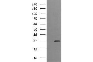 Image no. 1 for anti-Trafficking Protein Particle Complex 4 (TRAPPC4) antibody (ABIN1501264) (TRAPPC4 anticorps)