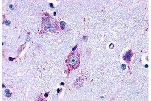 Anti-EDG7 antibody  ABIN1048537 IHC staining of human brain, amygdala. (LPAR3 anticorps  (Cytoplasmic Domain))