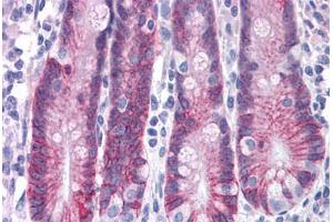 Human Small Intestine: Formalin-Fixed, Paraffin-Embedded (FFPE)