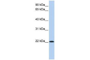 WB Suggested Anti-RNASE11 Antibody Titration: 0. (RNASE11 anticorps  (Middle Region))