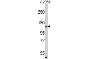 Western blot analysis of HMHA1 Antibody (Center) in A2058 cell line lysates (35ug/lane). (HMHA1 anticorps  (Middle Region))