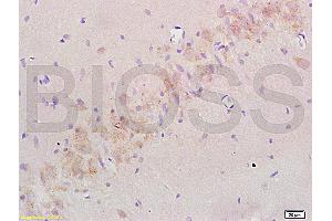 Formalin-fixed and paraffin embedded: rat brain tissue labeled with Anti-Nogo-A Polyclonal Antibody (ABIN725480), Unconjugated at 1:200 followed by conjugation to the secondary antibody and DAB staining (Reticulon 4 anticorps  (AA 301-400))