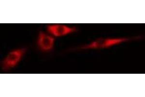 ABIN6274981 staining Hela cells by IF/ICC. (CDC42EP4 anticorps  (Internal Region))