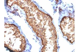 Formalin-fixed, paraffin-embedded human Testis stained with VCL Mouse Monoclonal Antibody (VCL/2572).